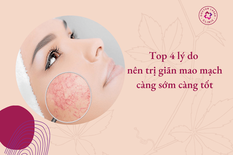 Top 4 lý do nên trị mao mạch càng sớm càng tốt