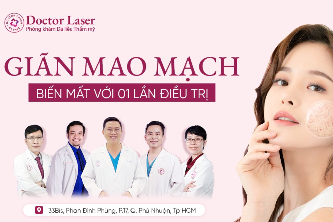 Bệnh giãn mao mạch là gì? Điều trị giãn mao mạch ở đâu?